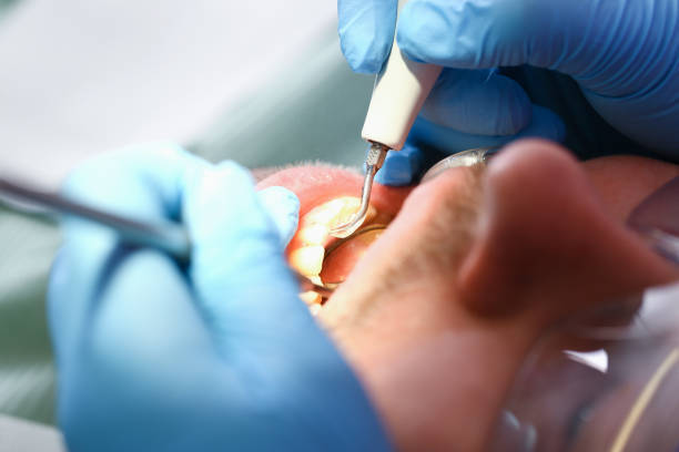 Best Weekend Emergency Dental Services in North Kansas City, MO